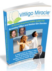 Vitiligo Miracle - Does It Work?